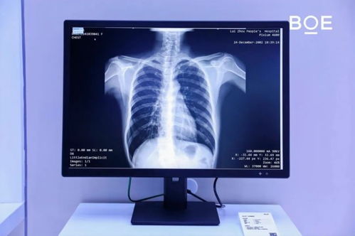 icdt 2025 boe 京東方 攜前沿顯示技術亮相 綠色 科技 引領產業持續向新